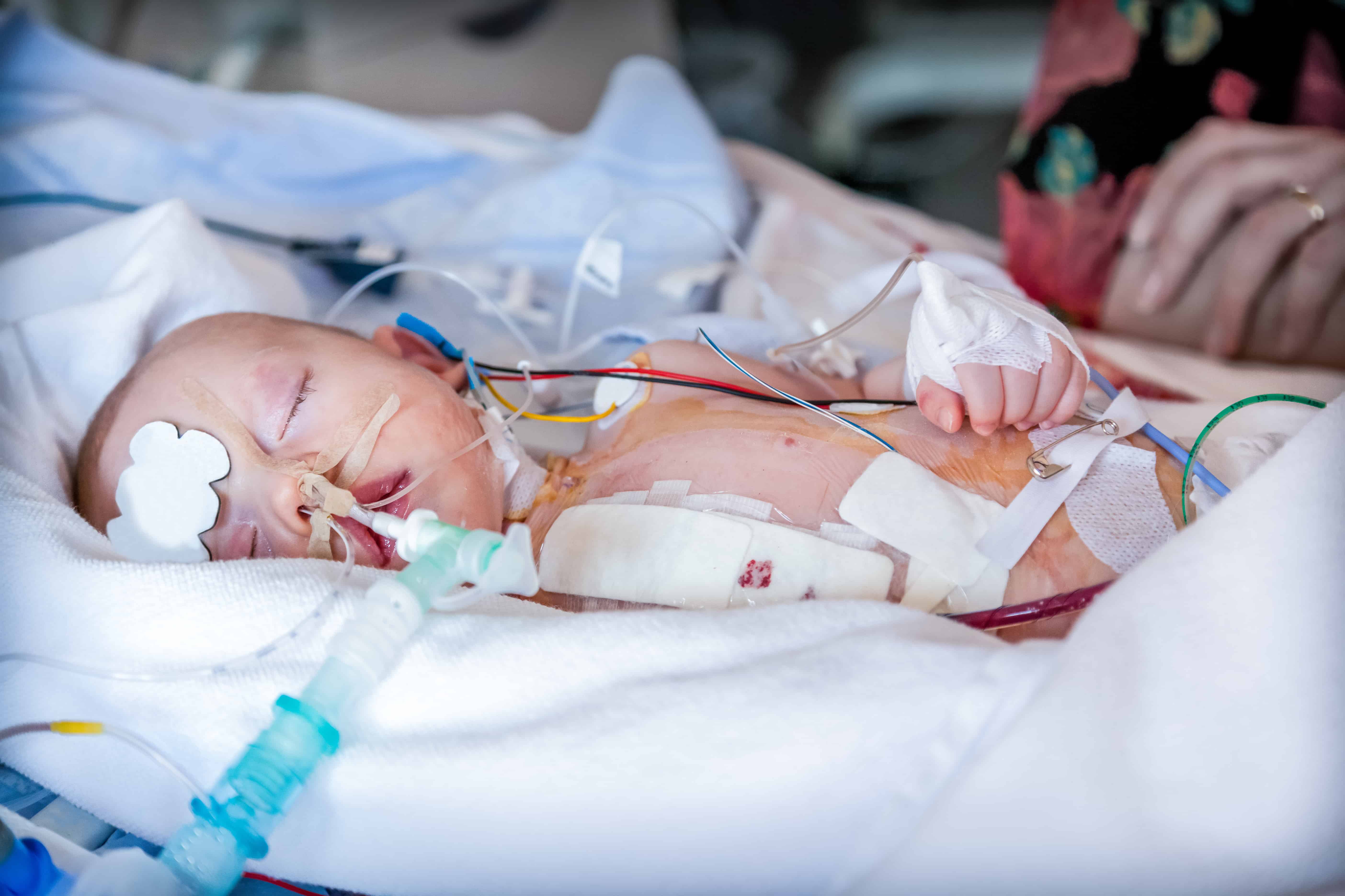 Child In Intensive Care Unit After Heart Surgery Shallow Depth Of 